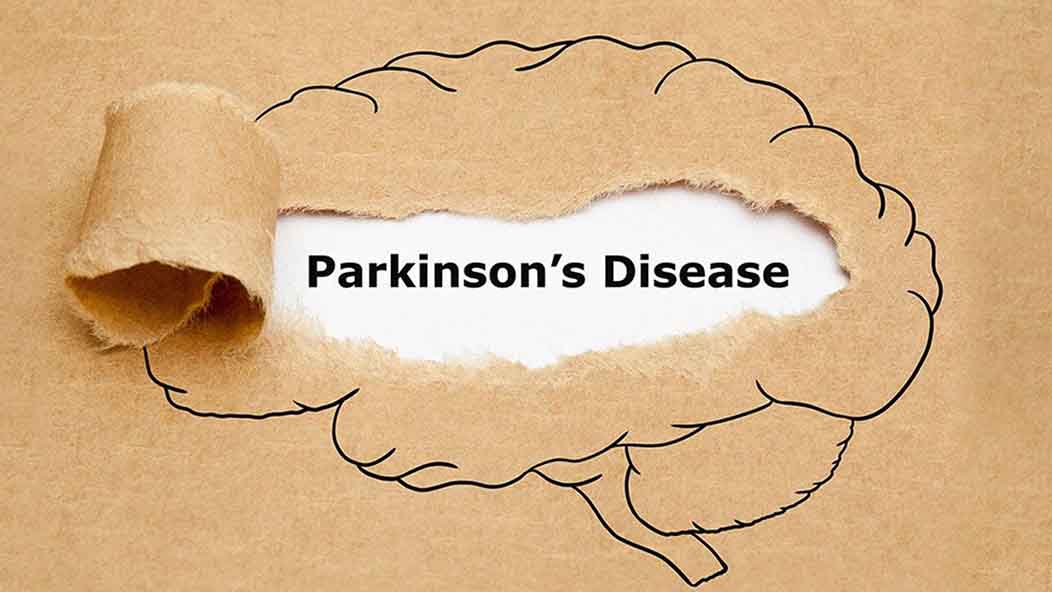 Could an FDA-approved cancer drug help stop Parkinson’s disease progression?