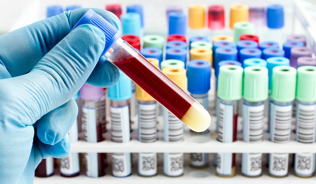 Protein ‘signatures’ in a single blood test could help detect over 60 conditions