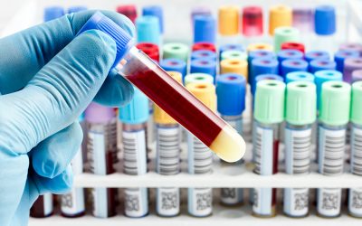 Protein ‘signatures’ in a single blood test could help detect over 60 conditions